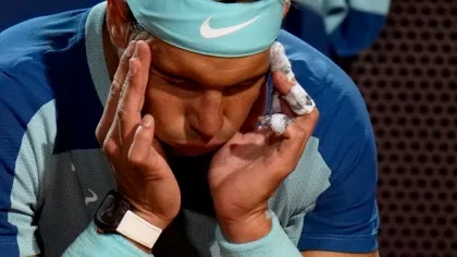 The disease that Rafael Nadal suffers from is rare and incurable.  Sad announcement...