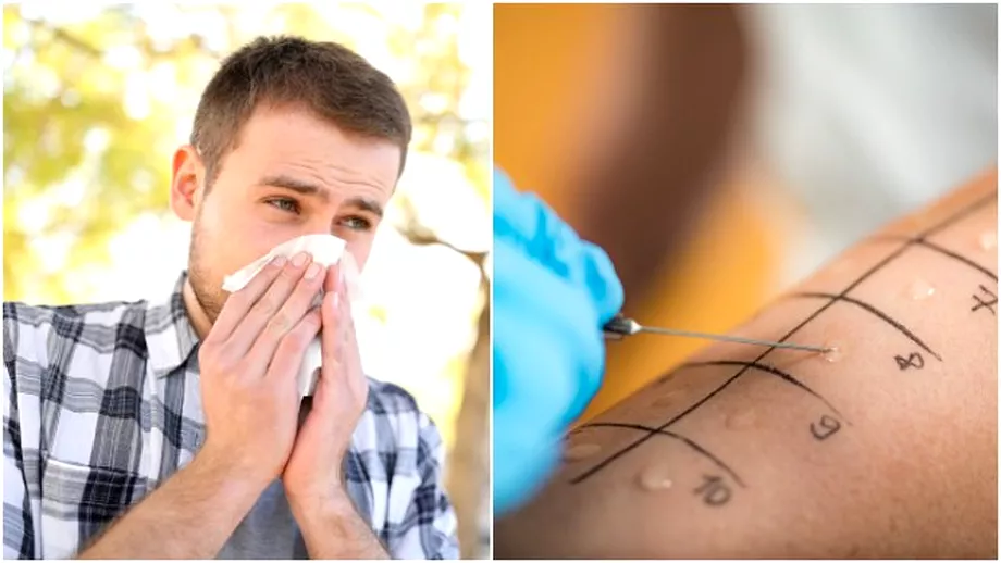 Este oficial Persoanele suspecte de alergii beneficiaza de analize si teste gratuite