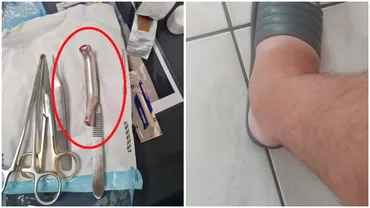 Caz socant la un spital din Prahova un medic a uitat manerul franei de la bicicleta in rana pacientului