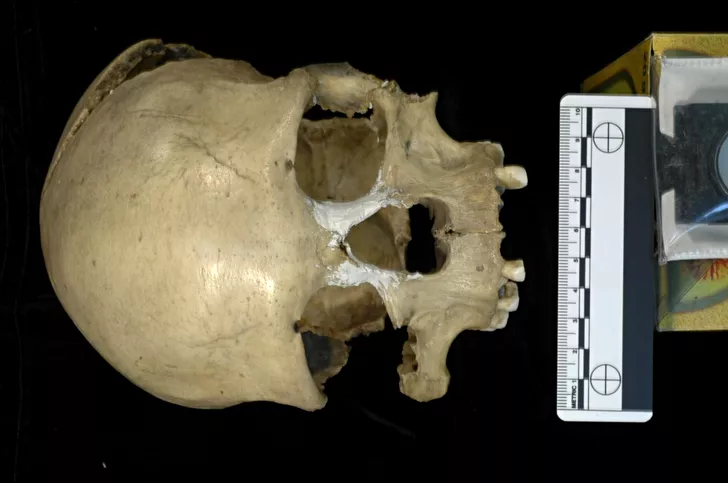 Craniul femeii din Peștera Muierii. Sursa foto :E. Trinkaus and A. Soficaru, eurekalert.org.
