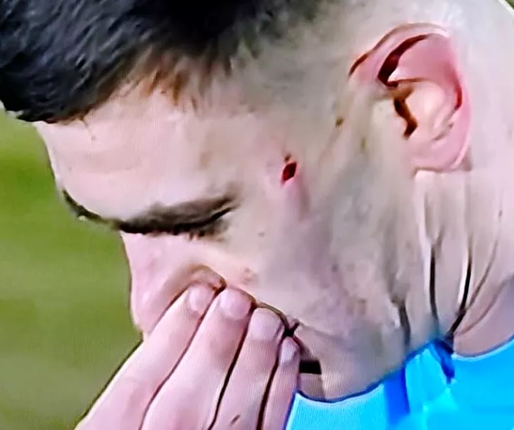 Igor Armaș avea pe față urmele crampoanelor lui Edjouma. Sursa foto: captură tv
