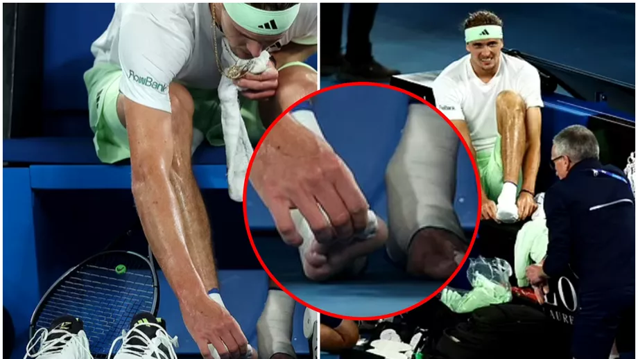 Alexander Zverev a jucat cu dureri ingrozitoare la Australian Open Neamtul chinuit de o problema medicala FOTO