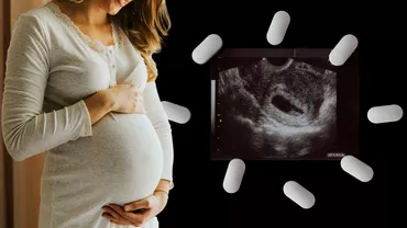 Dreptul la avort ar putea fi garantat in Romania Spitalele obligate sa aiba cel putin un medic care sa faca chiuretaje