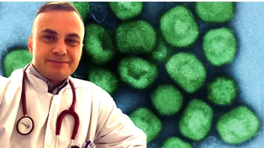 Risc mai mare de infectare cu variola maimutei pentru anumiti romani Medicul Adrian Marinescu a confirmat