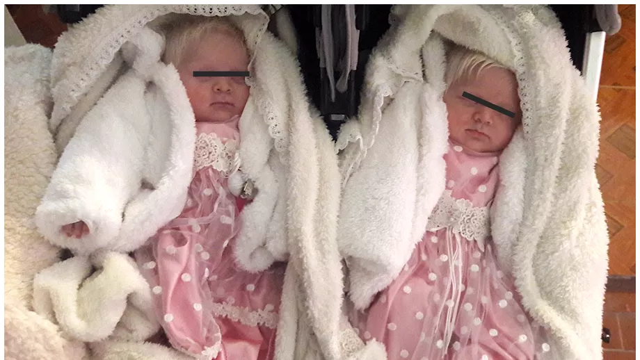 Cum arata acum gemenele nascute cu parul alb ca zapada Catalina si Virginia au patru ani