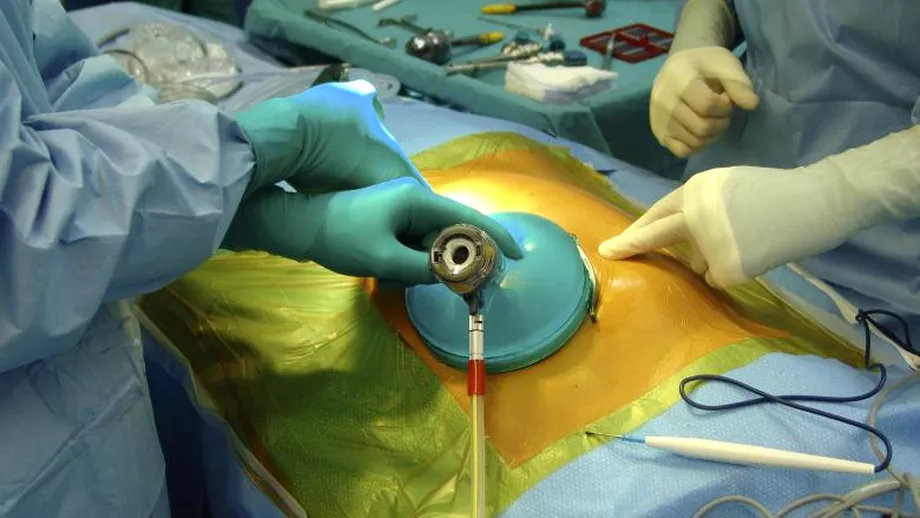 SOCANT Trafic de organe si transplanturi interzise de lege la Institutul Fundeni 30000 euro un rinichi