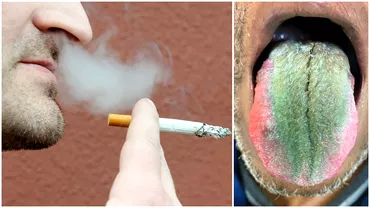 Cum a ajuns un fumator sa aiba limba verde si paroasa Explicatiile medicilor
