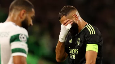 Karim Benzema a iesit accidentat in meciul Celtic  Real Madrid Francezul a parasit terenul schiopatand Video