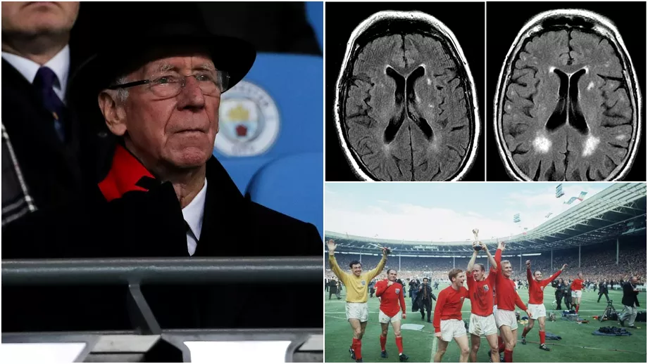 Alzheimer boala marilor campioni ai fotbalului britanic Tot mai multe legende sunt lovite de cumplita maladie
