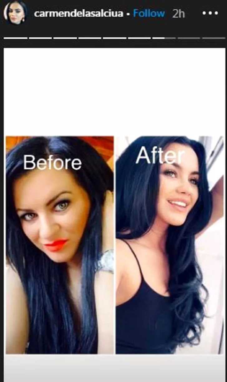 Carmen de la Sălciua, înainte și după operațiile estetice. Sursa foto: Instagram