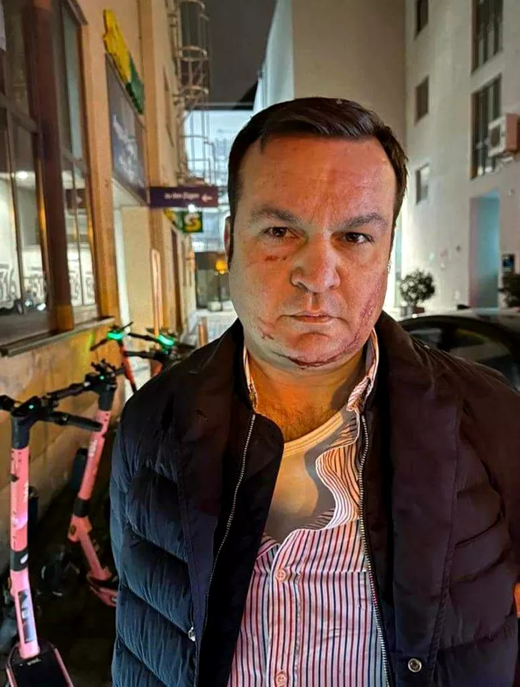Cătălin Cherecheş cu răni pe faţă, după ce a fost prinsFoto: Facebook