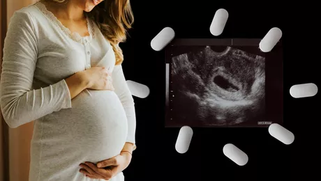 Dreptul la avort ar putea fi garantat in Romania Spitalele obligate sa aiba cel putin un medic care sa faca chiuretaje