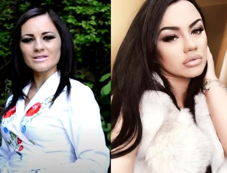 Carmen de la Sălciua, înainte și după operațiile estetice
