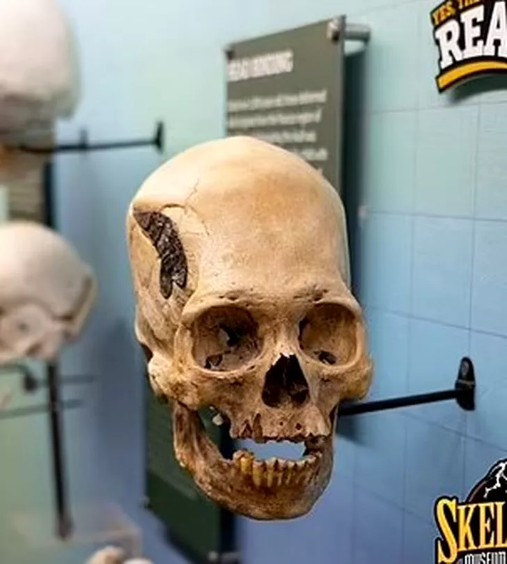 Craniu alungit Peru