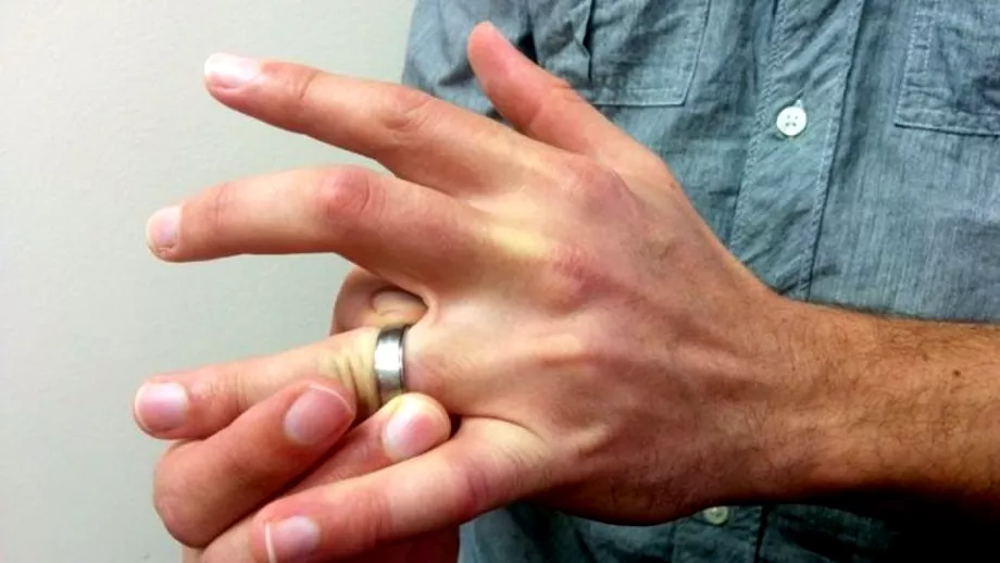 Cum poti sa scoti un inel de pe un deget umflat 5 trucuri pe care doar cei mai buni bijutieri le stiu