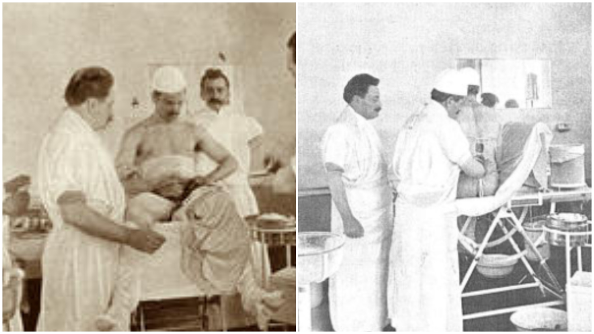 Alexandru Tzaicu e primul chirurg român care s-a operat singur: ”Simt o senzație plăcută, de la basin în jos, pare ca un curent lin, plăcut, gâdilitor”