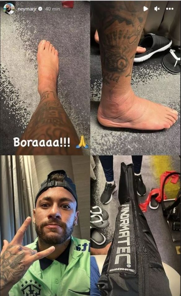 Cum arată glezna lui Neymar